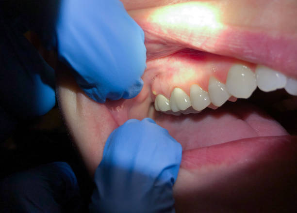 Best Broken or Cracked Tooth Emergency Dentist in Waterloo, IL