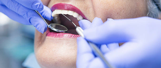 Best Emergency Dental Extractions in Waterloo, IL